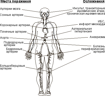осложнения при атеросклерозе