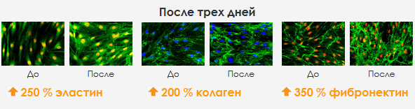 продуцирование-волокон-кожи