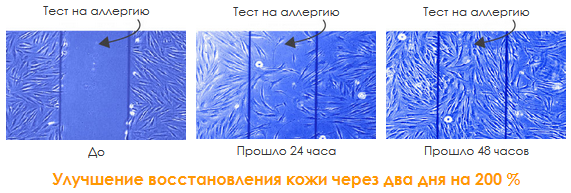 восстановление-кожи-после-повреждения