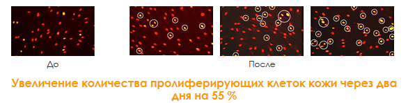 пролиферация-клеток-кожи