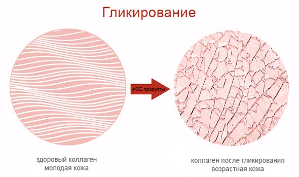 коллаген после гликирования в коже